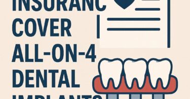Does Insurance Cover All-on-4 Dental Implants