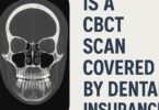 Is a CBCT Scan Covered by Dental Insurance